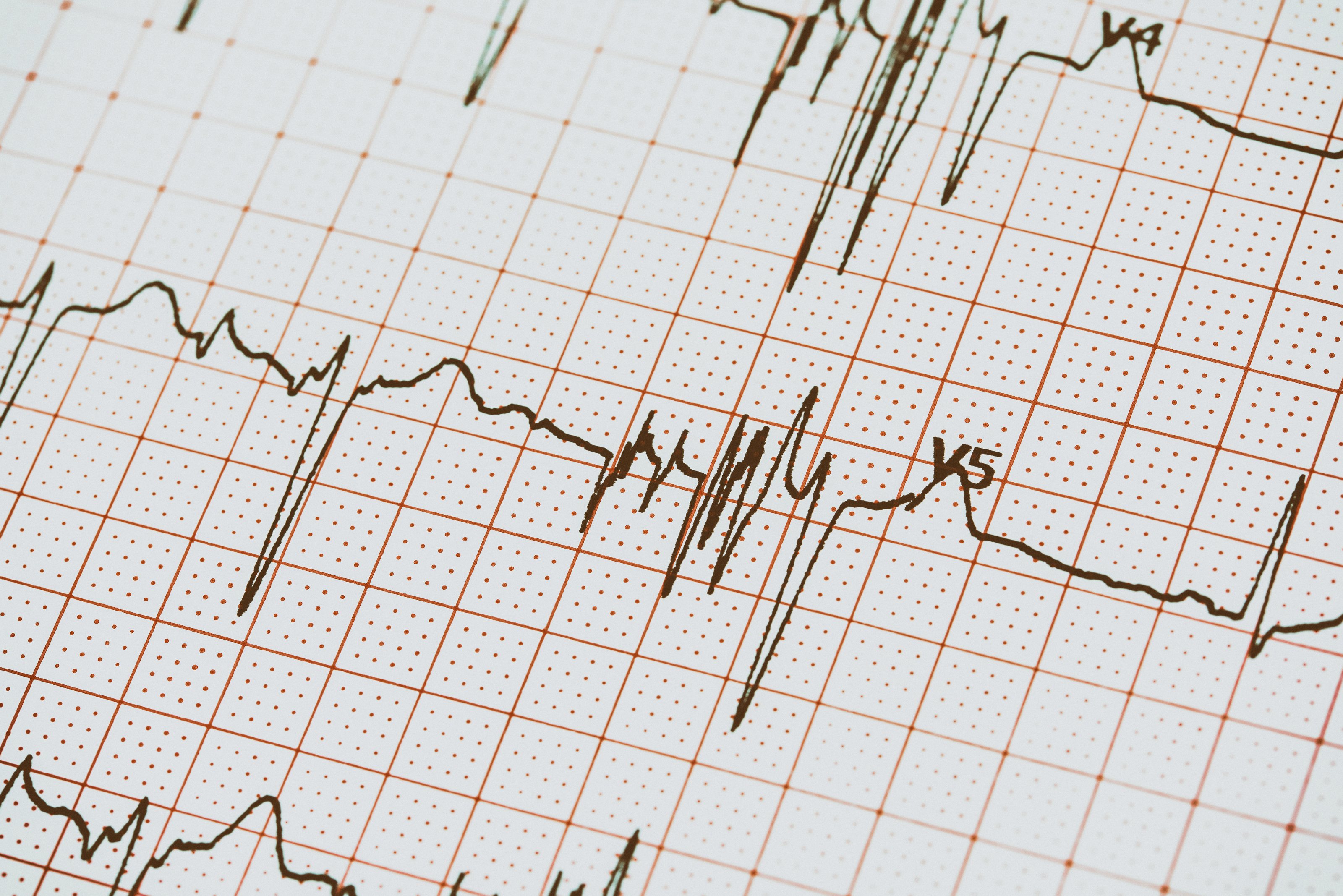 Hand aufs Herz beim EKG