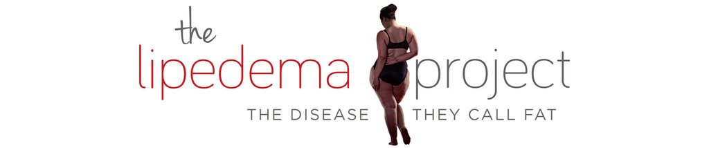 Lipedema: The Disease They Call FAT