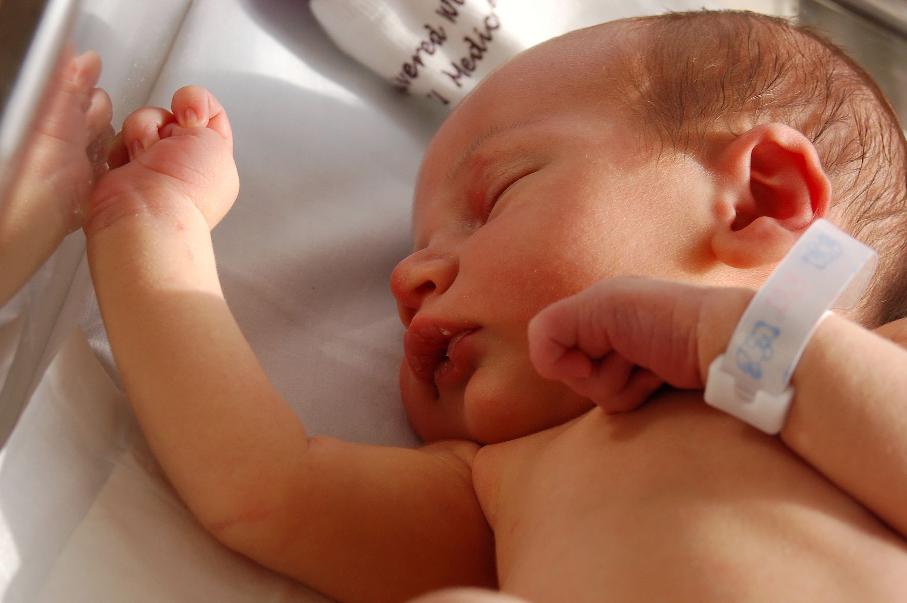Pre-eclampsia Symptoms, Risk Factors & What You Need To Know