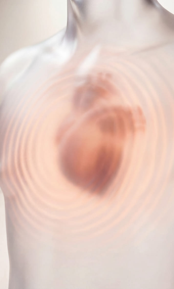 Impedance Cardiography