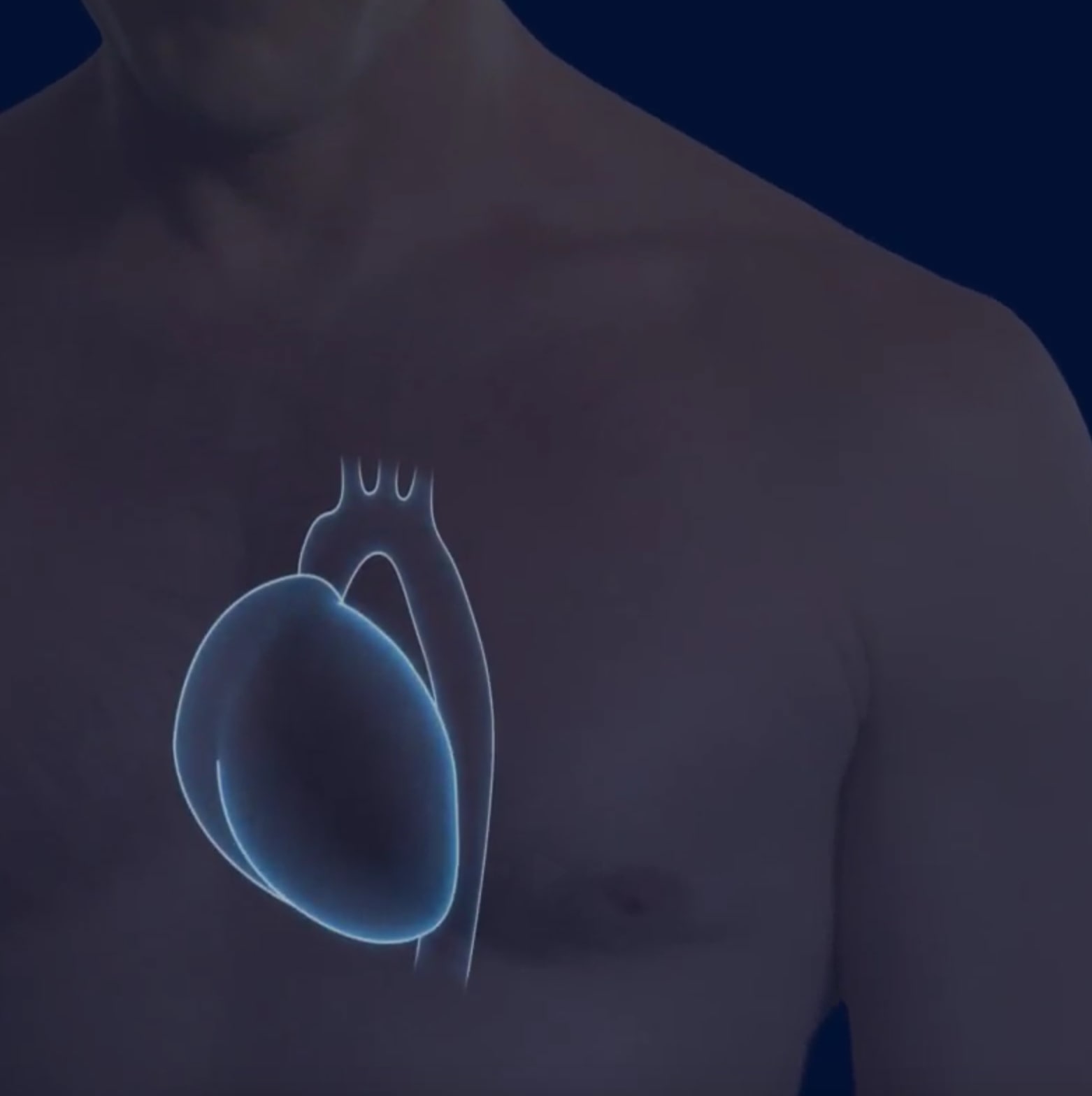 Pulse Wave Velocity: Measurement, Devices, and How to Reduce It